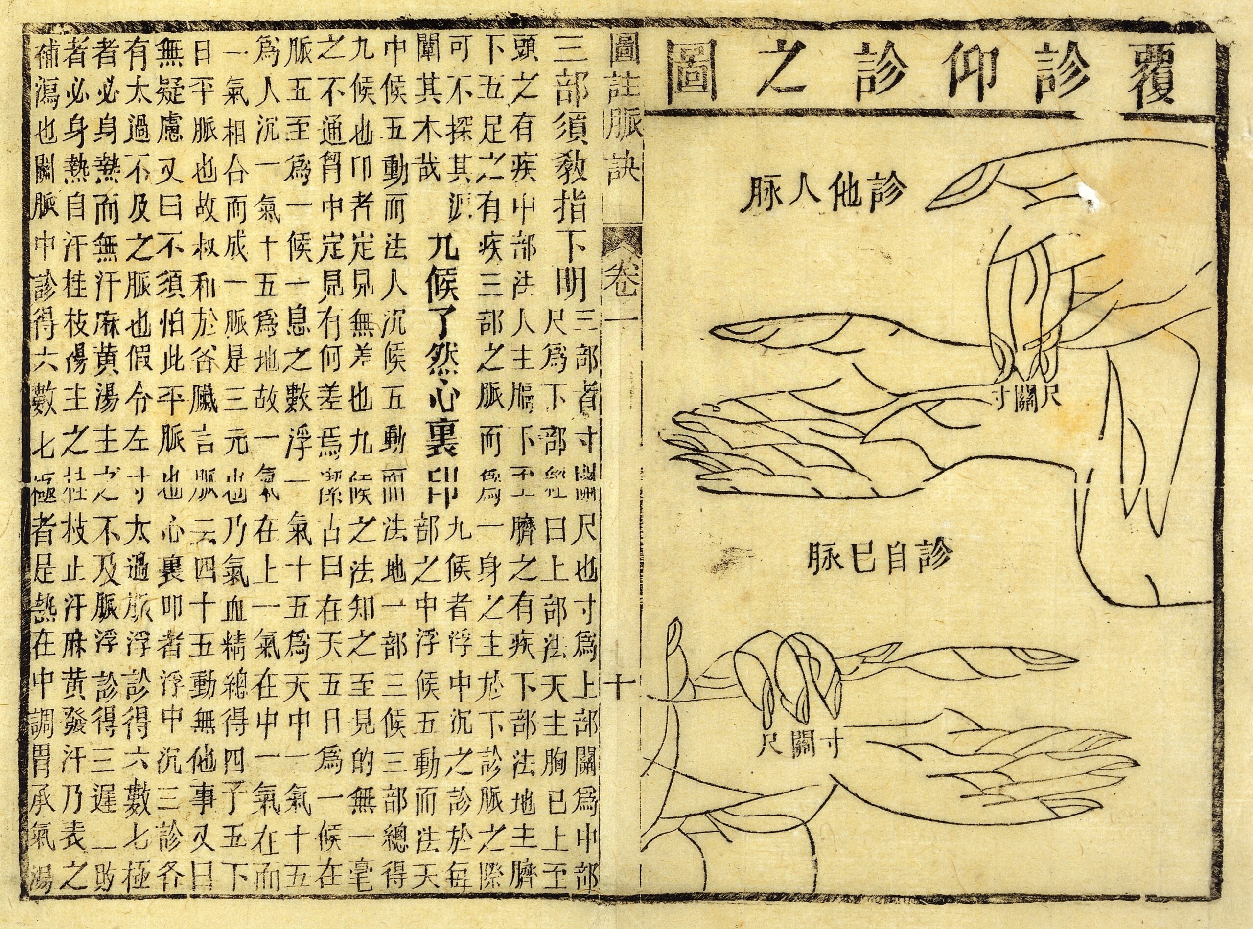 An illustration from a historic treatise on taking the pulse.