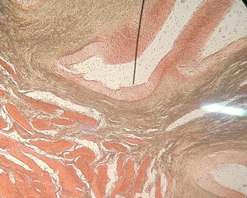 A stained histology section seen at high magnification