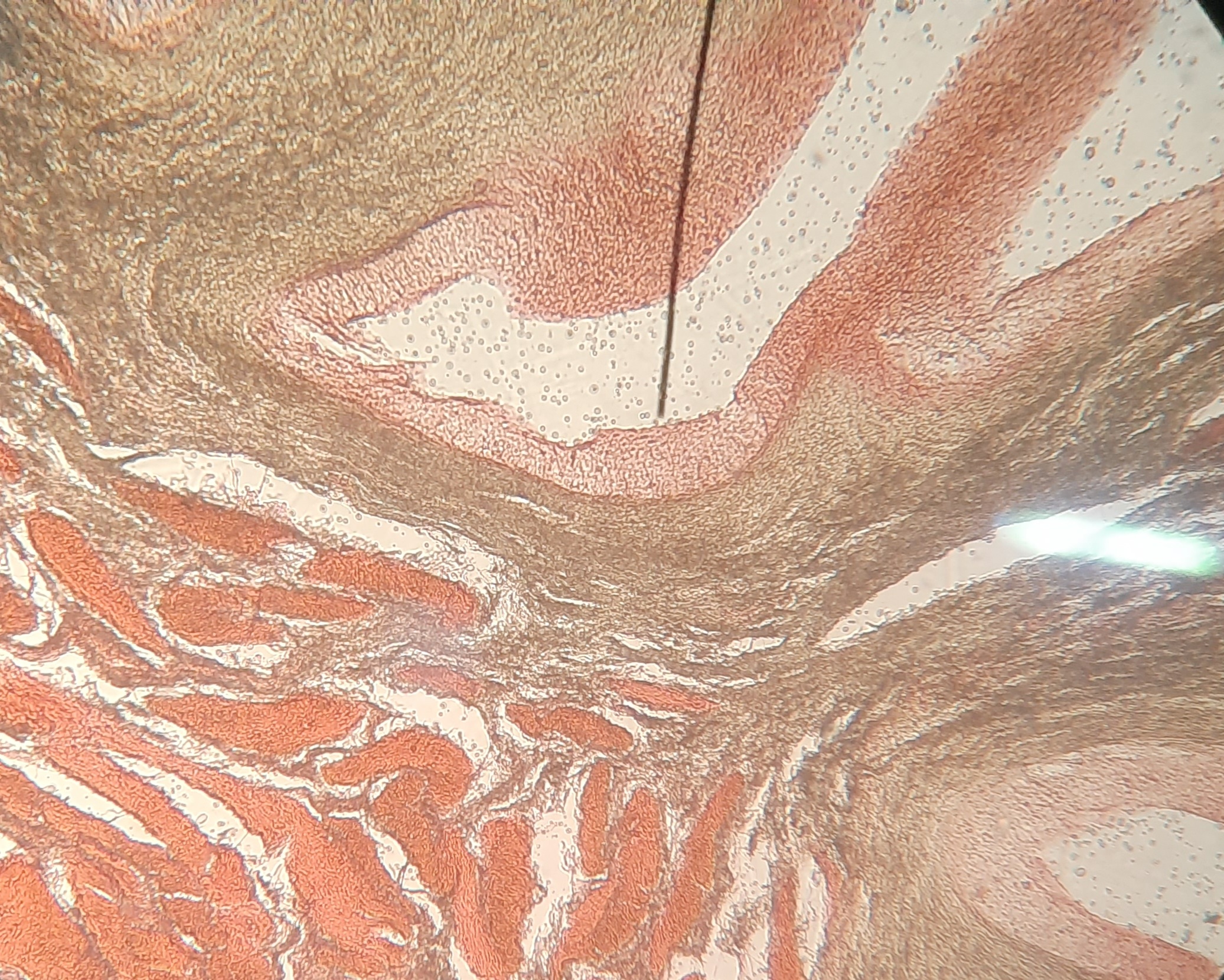 A stained histology section seen at high magnification